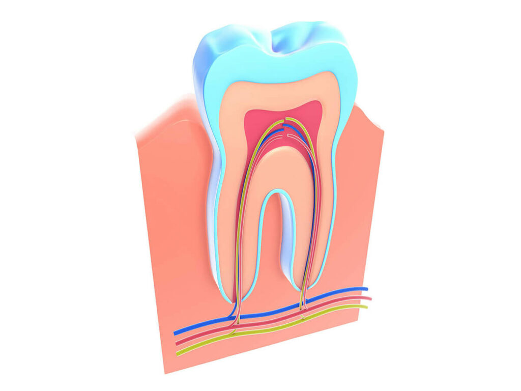 root canal graphic