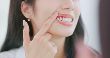 Close-up back view of woman looking in the mirror at inflamed and swollen gums feels ache uncomfortable—periodontal disease